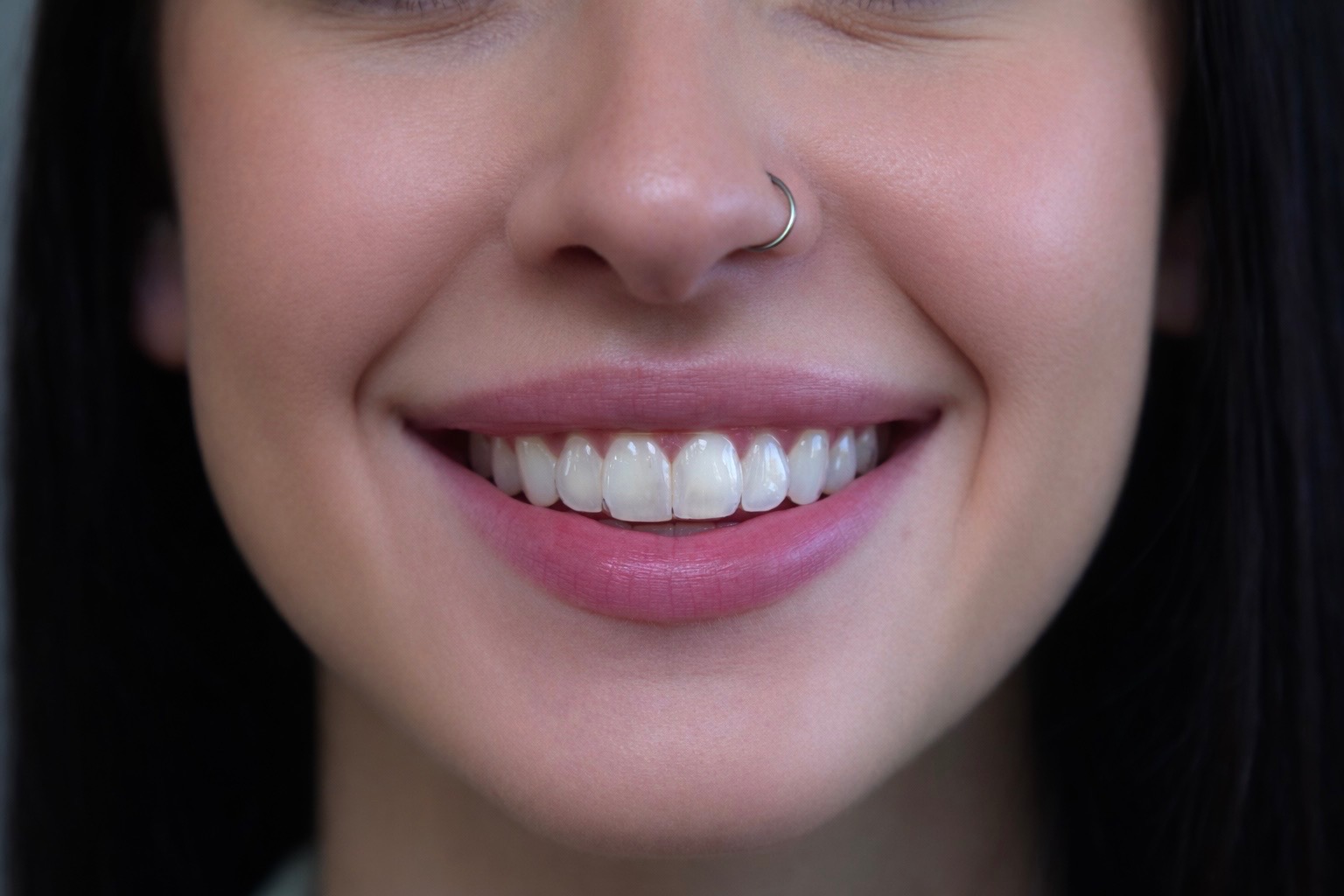 Smiling with clear aligners in, virtually invisible